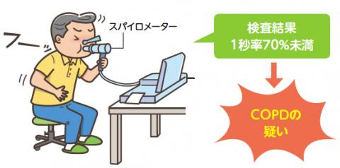 COPD検査